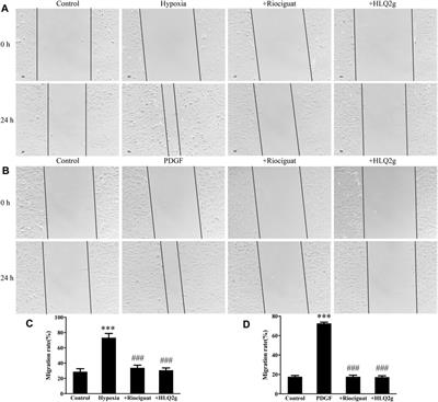 Novel Pyrazolo[3,4-b] Pyridine Derivative (HLQ2g) Attenuates Hypoxic Pulmonary Hypertension via Restoring cGKI Expression and BMP Signaling Pathway